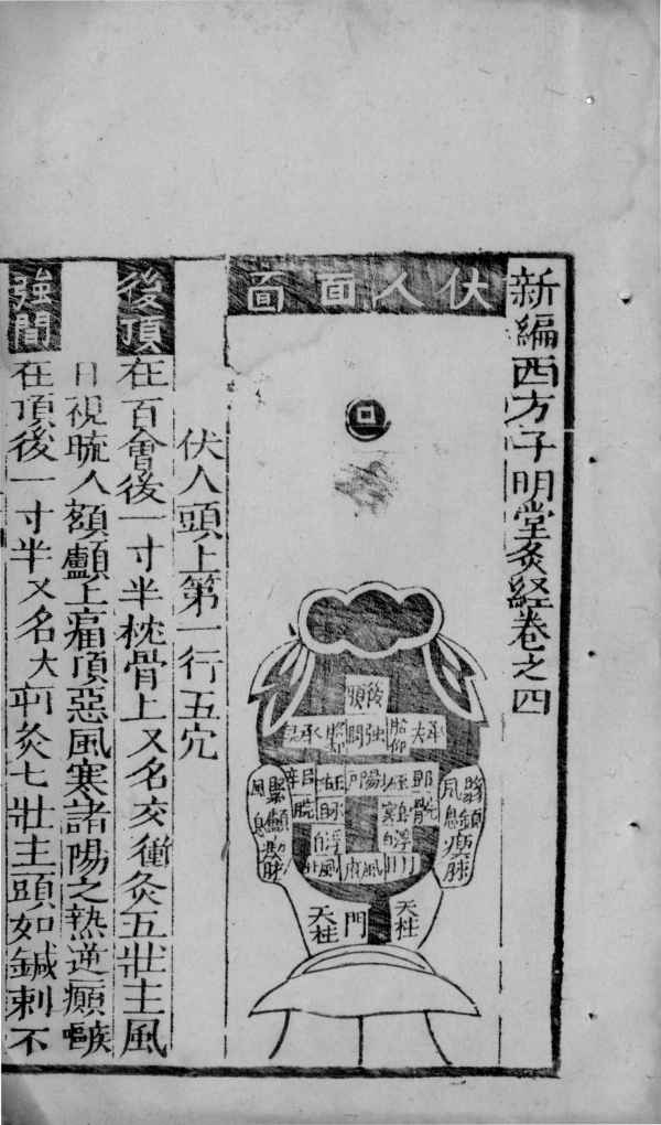 新编西方子明堂灸经  卷4